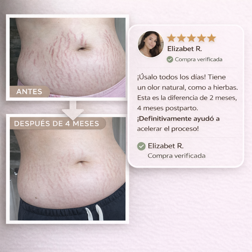 True Belly Serum anti-estrías prenatal