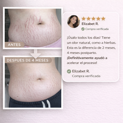 True Belly Serum anti-estrías prenatal